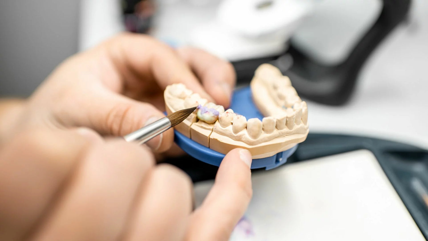 L'uso della stampa 3D per creare modelli tridimensionali di bocca e denti
